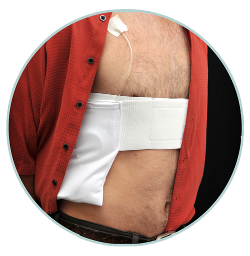 Infusion Pump, Medical device transporting system | Vertical style 11 Infusion Pump, Medical device transporting system | Vertical style 11